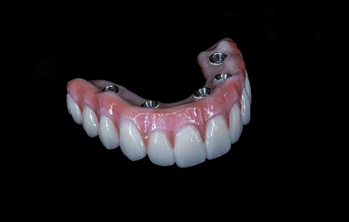 64c41e1b3e60f2f3575dda21 acrylic hybrid with titanium bar