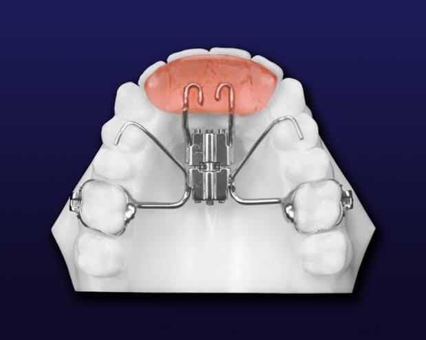 orthodontic