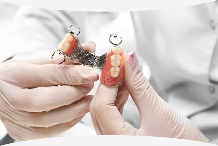 burbankdentallab removable partial denture dentist feature