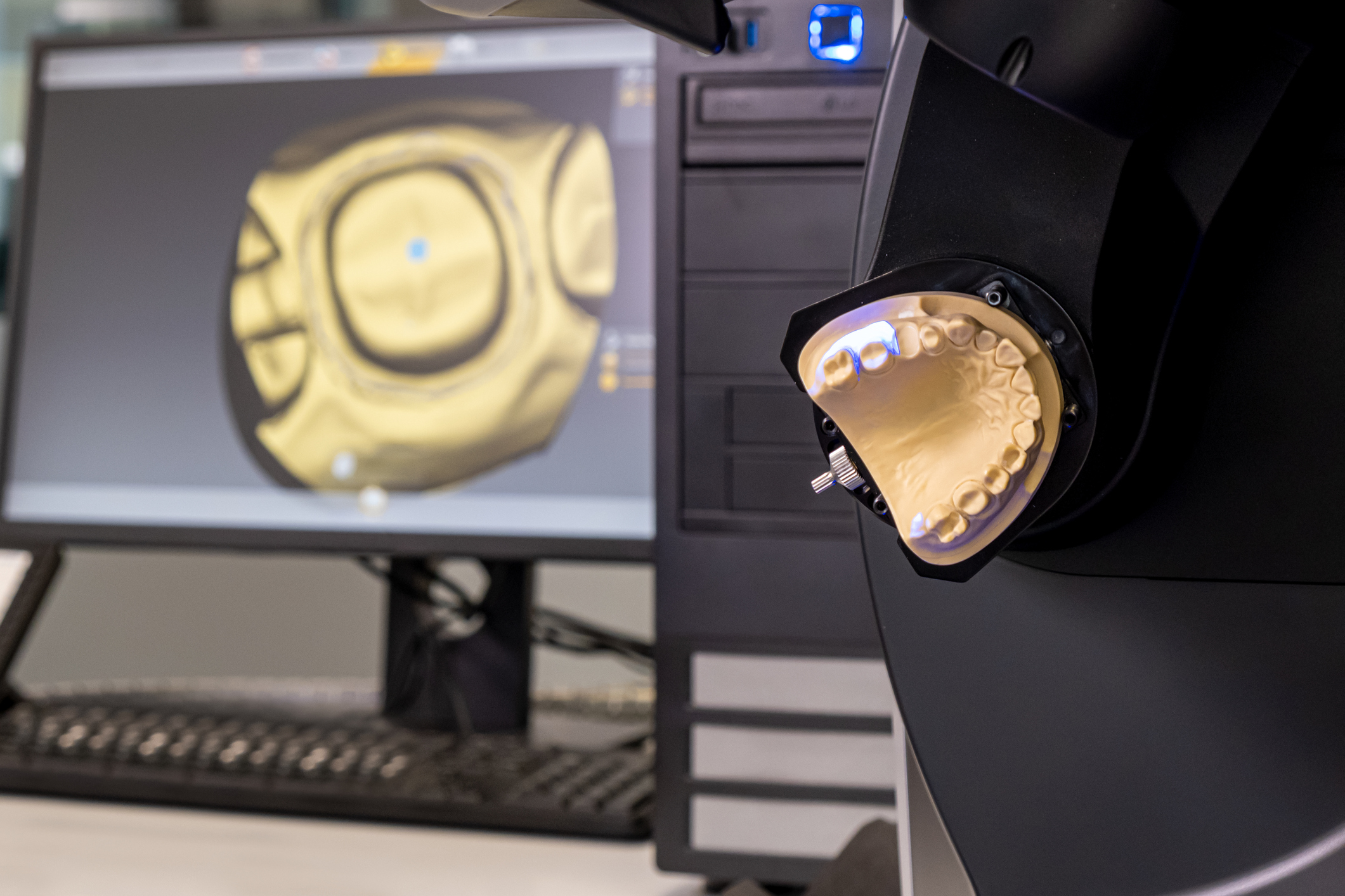cad cam equipment modern extraoral laboratory dental scanner. selective focus.