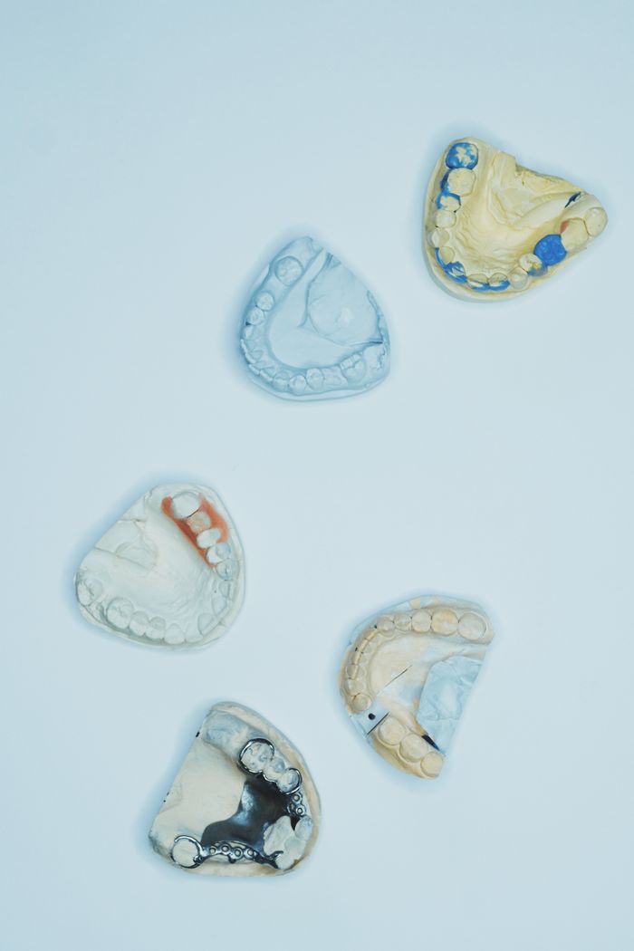 High-angle view of dental molds on a blue surface, showcasing dental care tools.
