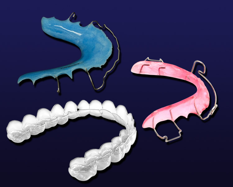 product ortho retainers 1