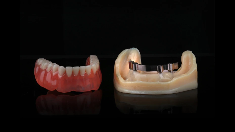 zambdentcareprecisionattachmentstelescopicattachments1x